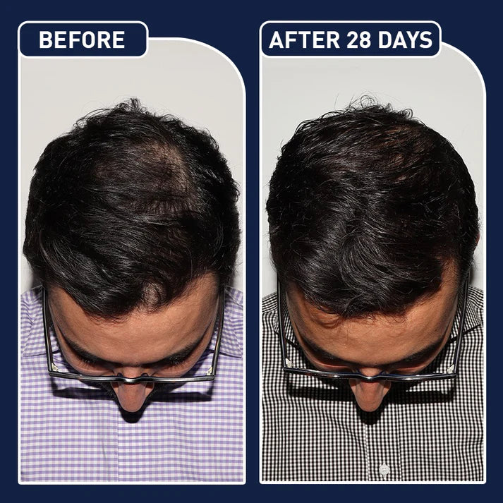 FEG PLUS HAIR GROWTH SPRAY