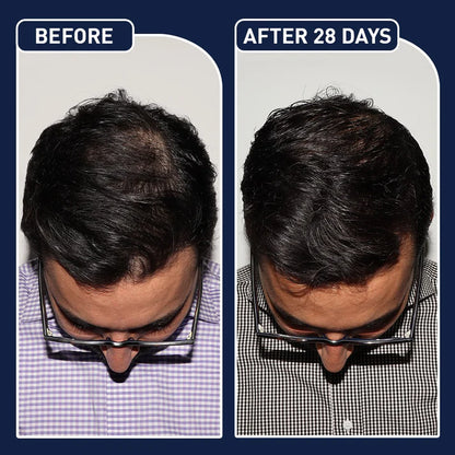 FEG PLUS HAIR GROWTH SPRAY
