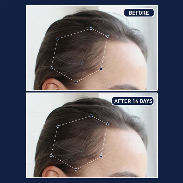 FEG PLUS HAIR GROWTH SPRAY