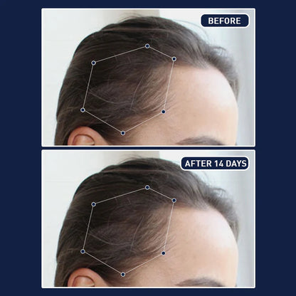 FEG PLUS HAIR GROWTH SPRAY